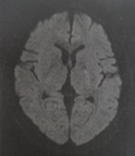 MRI画像2014年