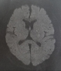 MRI画像2015年
