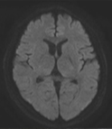 MRI画像2016年1